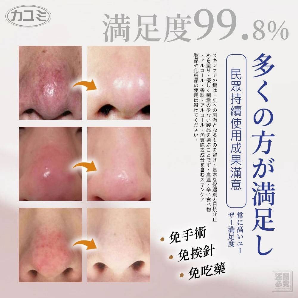 【24小時網站自助下單】2026年7月4日截🌸🟡日本カユミ-酒槽鼻專用修復毛孔膏20g🟡 | 預訂約8月尾至9月初