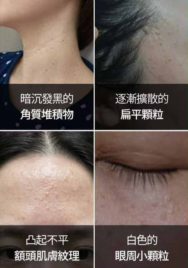 【24小時網站自助下單】2026年7月25日截🌸🇰🇷韓國藥局好物推薦🆕Dr.deepTT 礦物點點霜 新包裝40ml 改善肌膚顆粒、平滑粗糙、煥膚護理 | 預訂約3-4星期