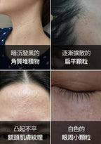 【24小時網站自助下單】2026年7月25日截🌸🇰🇷韓國藥局好物推薦🆕Dr.deepTT 礦物點點霜 新包裝40ml 改善肌膚顆粒、平滑粗糙、煥膚護理 | 預訂約3-4星期