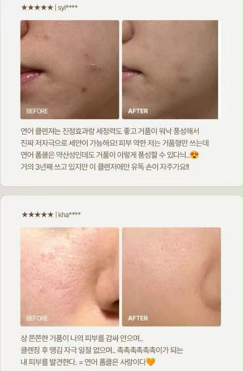 【24小時網站自助下單】2026年7月25日截🌸韓國🇰🇷最新出🆕Olive Young 常駐熱銷榜 HEVEBLUE 專業修護王牌潔面200ml | 預訂約3-4星期