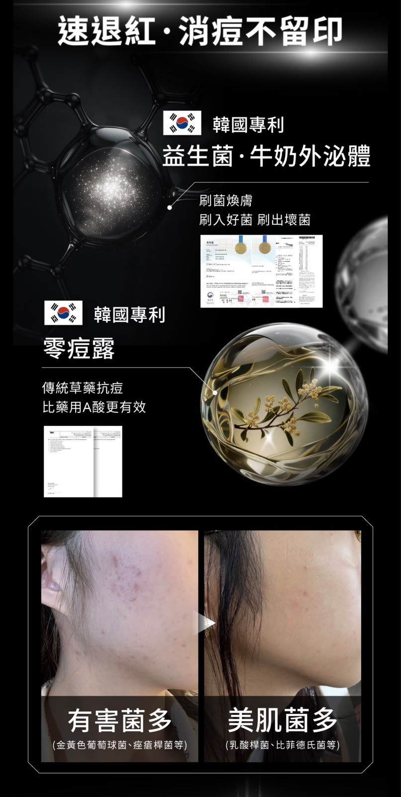 【24小時網站自助下單】🌸新品🩶台灣 Relove 控油零痘水凝棉片195 ml (90 片/盒) | 預訂約1-2星期 娉婷貿易公司 Exquisite Beauty Trading Company