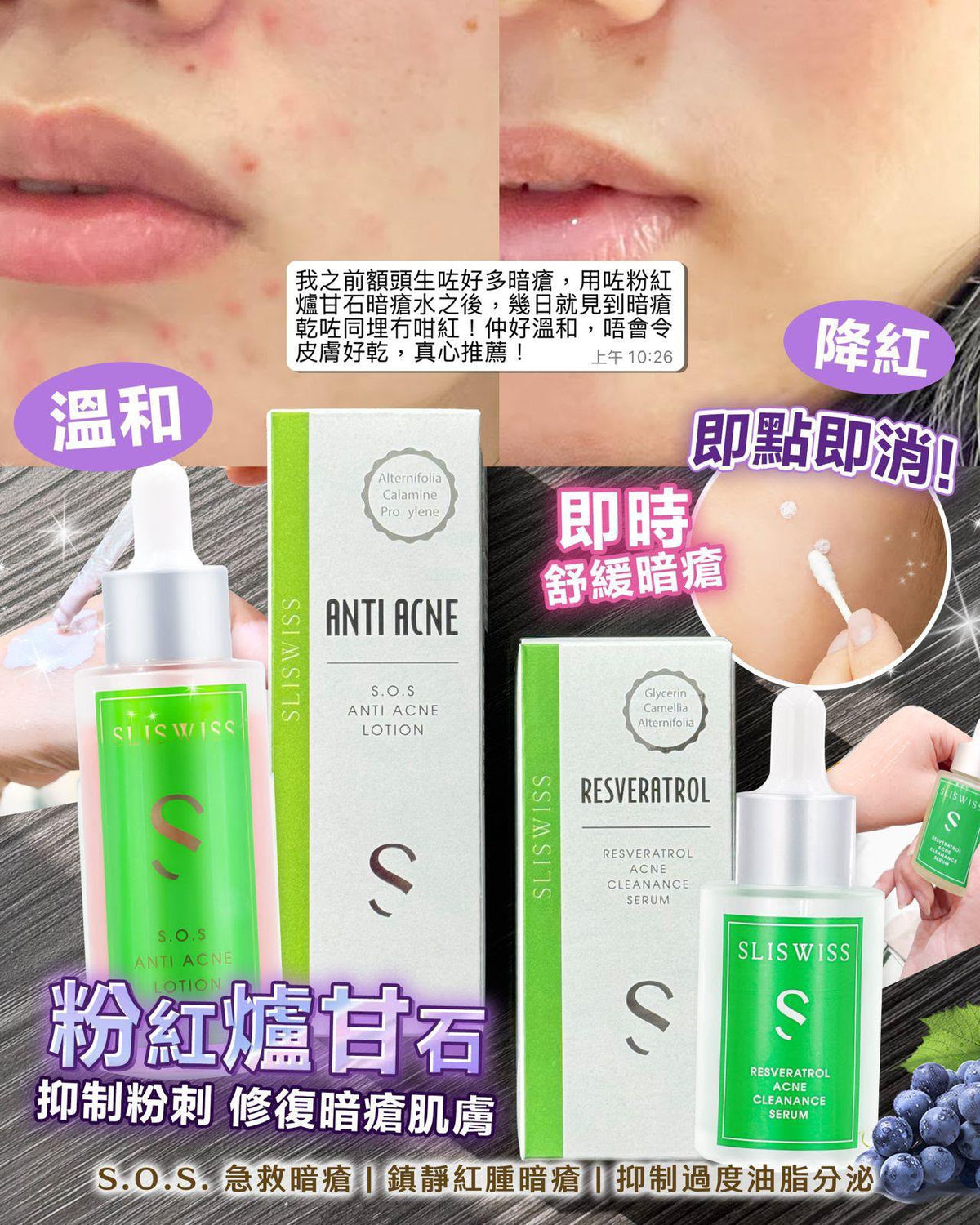 【24小時網站自助下單】售完即止🌸📣《Sliswiss 急救爛面抗痘孖寶》🔥急救孖寶 急救爛面精華＋急救鉗清水【千年痘痘終極救星】🌟 | 預訂約1-2星期 娉婷貿易公司 Exquisite Beauty Trading Company