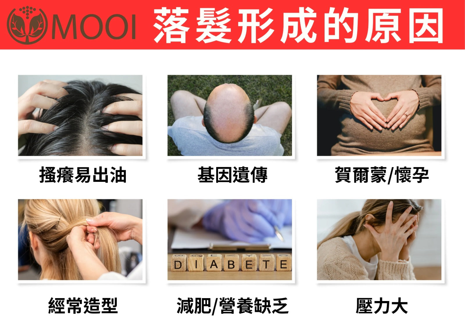 【24小時網站自助下單】🌸MOOI 密髮森洗髮露 200ML | 預訂約4-5星期 娉婷貿易公司 Exquisite Beauty Trading Company