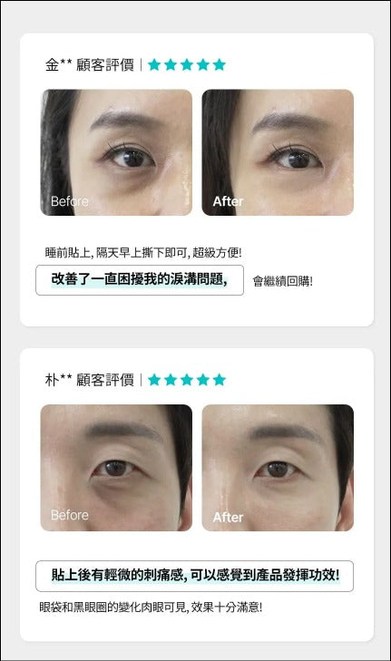 【24小時網站自助下單】售完即止🌸CHARDE 提拉去紋微針貼 ( 4 SETS) | 預訂 落單後約2026年10月中至尾【不設現貨】 娉婷貿易公司 Exquisite Beauty Trading Company