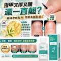 【24小時網站自助下單】2026年9月11日截🌸韓國withshyan指甲深層滋養茶樹精華15ml | 預訂約10月尾至11月初 娉婷貿易公司 Exquisite Beauty Trading Company