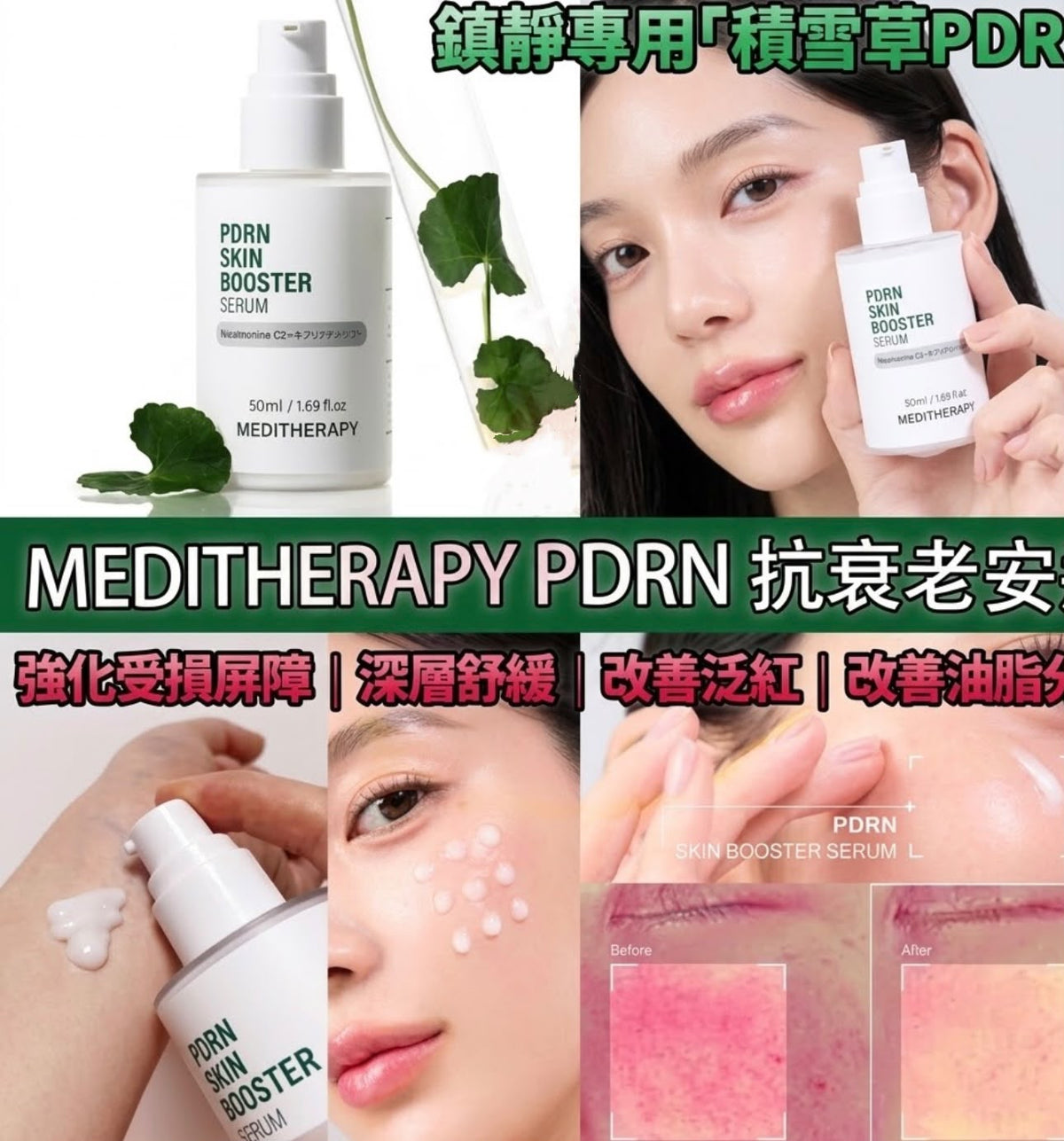 【24小時網站自助下單】2026年9月18日截🌸韓國🇰🇷直送MEDITHERAPY PDRN 抗衰老修護再生精華100ml | 預訂約10月尾至11月初 娉婷貿易公司 Exquisite Beauty Trading Company