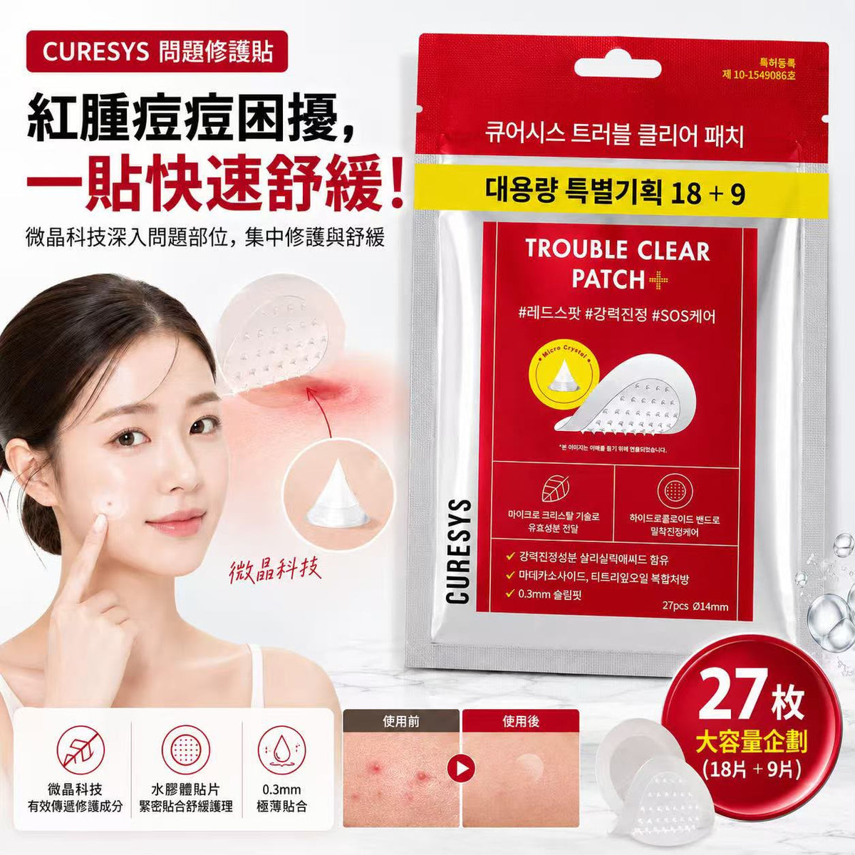 現貨 | CURESYS Trouble Clear Patch+ 痘痘修護貼 娉婷貿易公司 Exquisite Beauty Trading Company