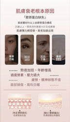 現貨 | 🔥🔥代理貨🔥ILO - Type 1 膠原蛋白安瓶 - 28日份 娉婷貿易公司 Exquisite Beauty Trading Company