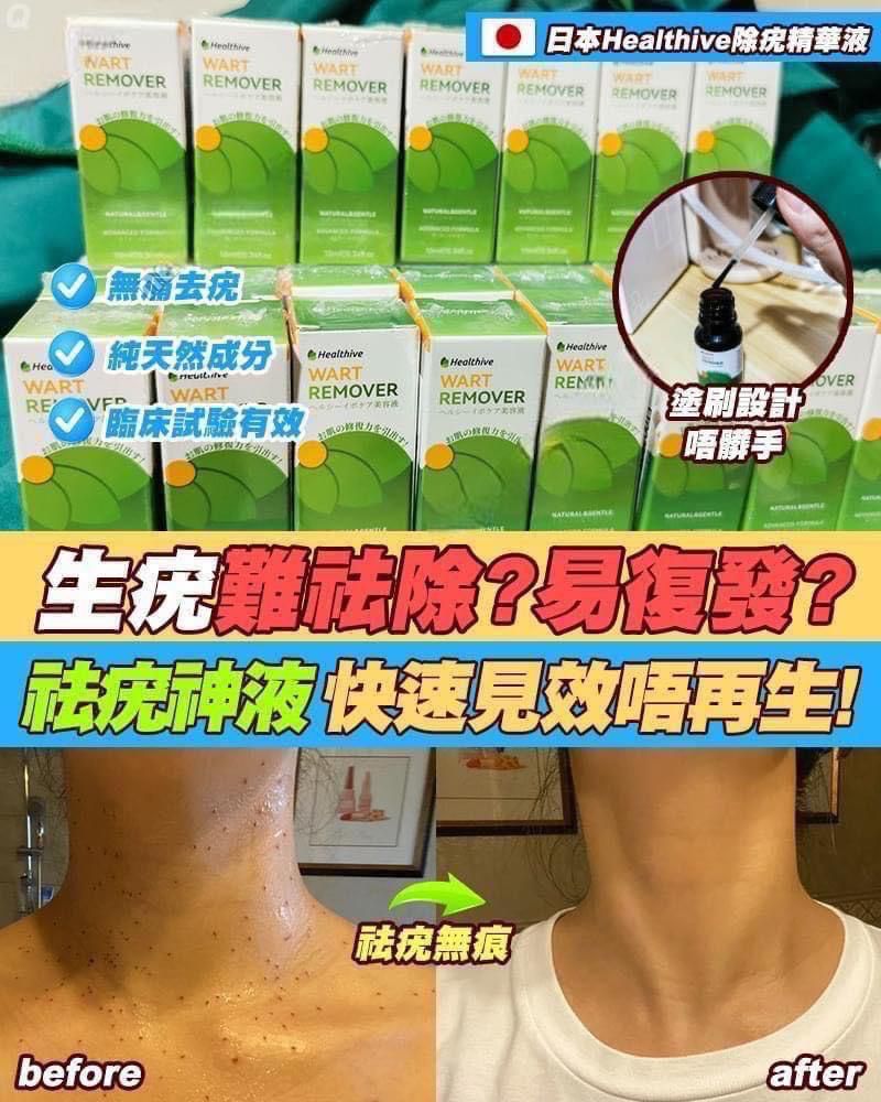 現貨🌸日本Healthive除疣無印非藥性精華液 | 落單後約3-5個工作天寄出 娉婷貿易公司 Exquisite Beauty Trading Company