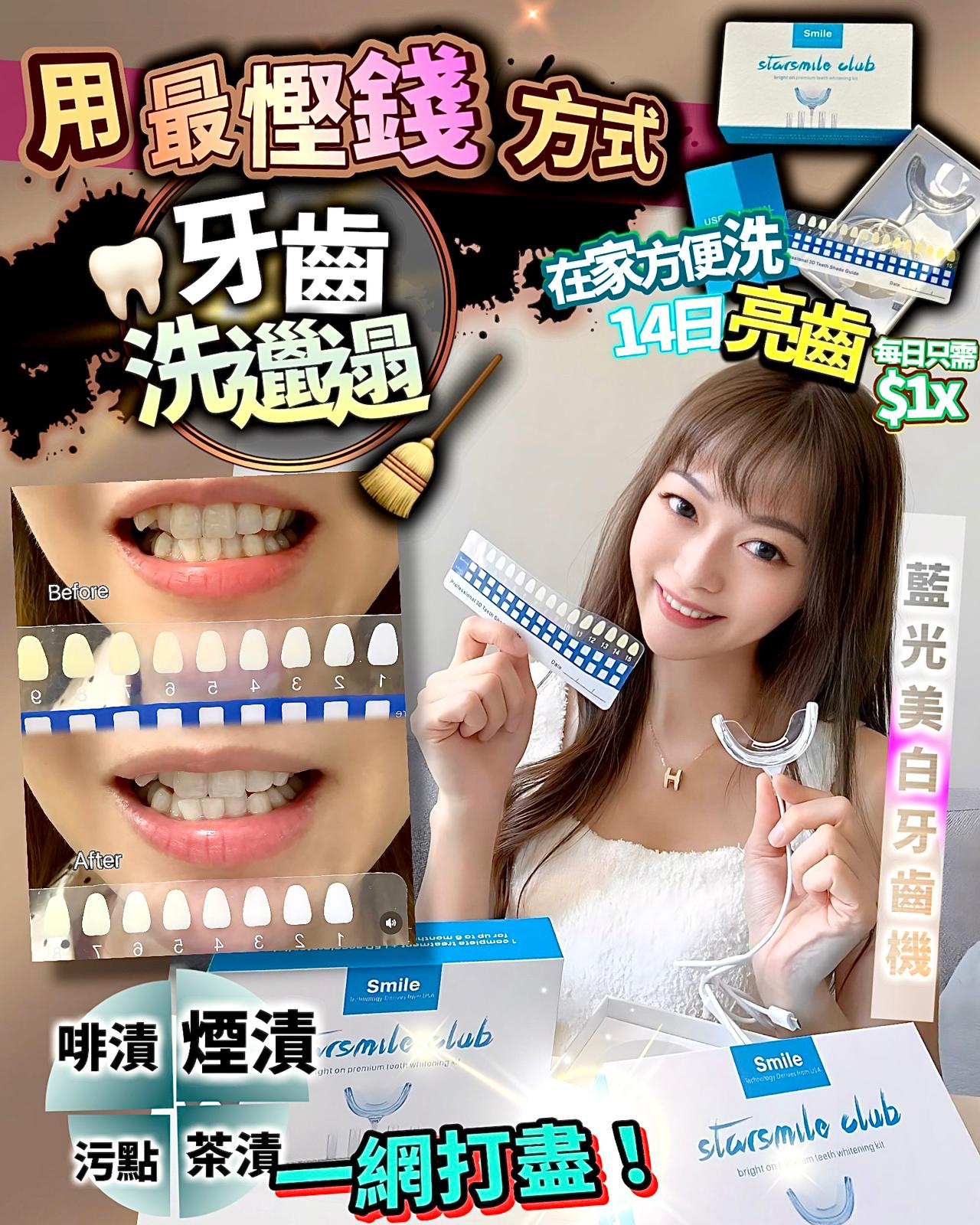 🌸StarSmileClub美國🇺🇸藍光美白牙齒機 | 預訂約2-3星期