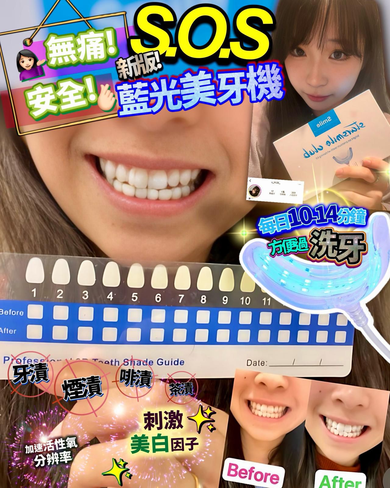 🌸StarSmileClub美國🇺🇸藍光美白牙齒機 | 預訂約2-3星期
