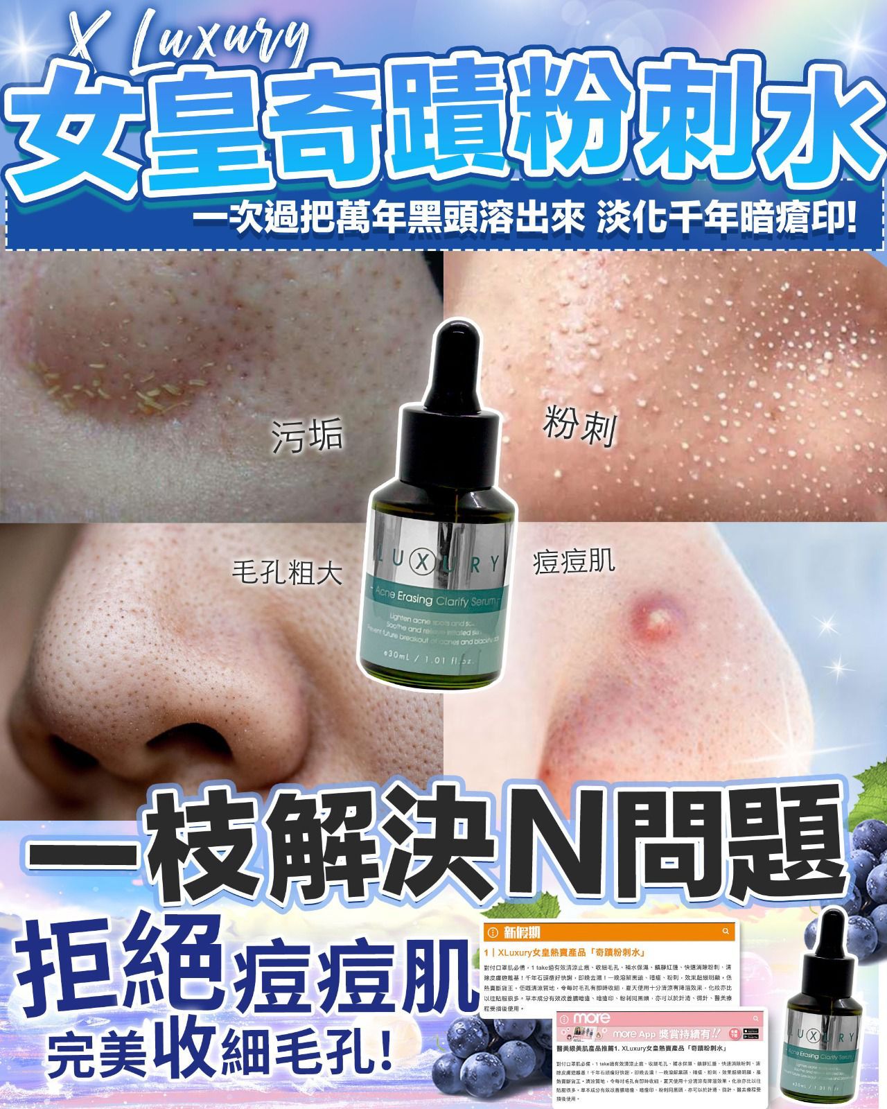 🌸女皇奇蹟粉刺水 30ml | 預訂約2星期 娉婷貿易公司 Exquisite Beauty Trading Company