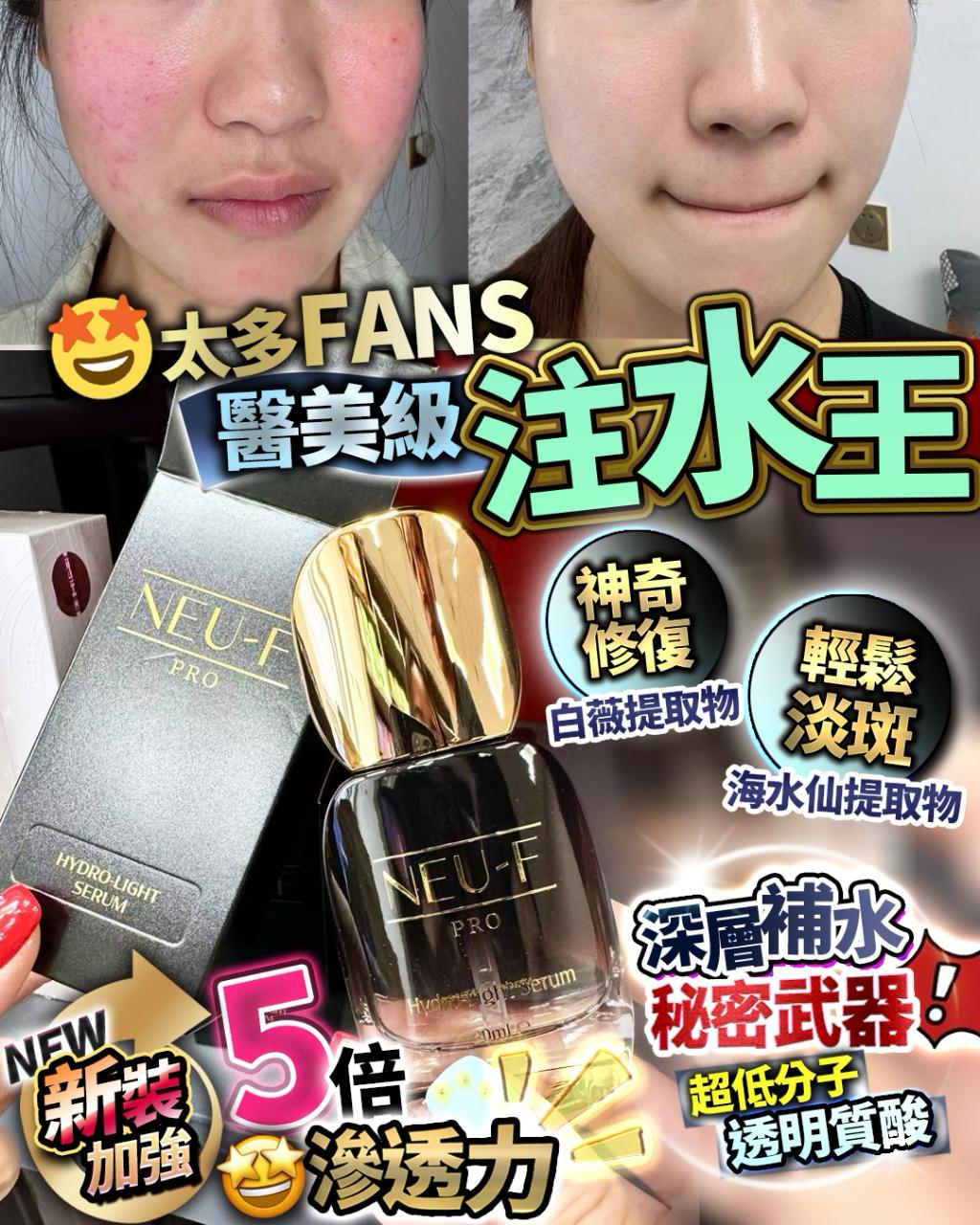 🌸新版注水王 | 預訂約2星期