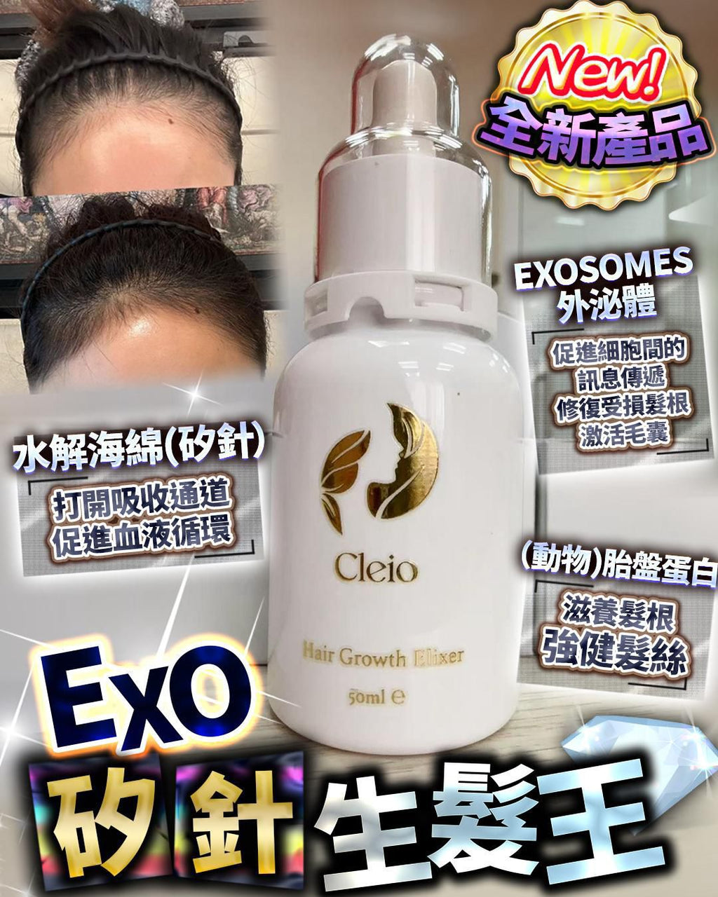 現貨🌸Cleio 外泌體矽針生髮王 | 落單後約3-5個工作天寄出