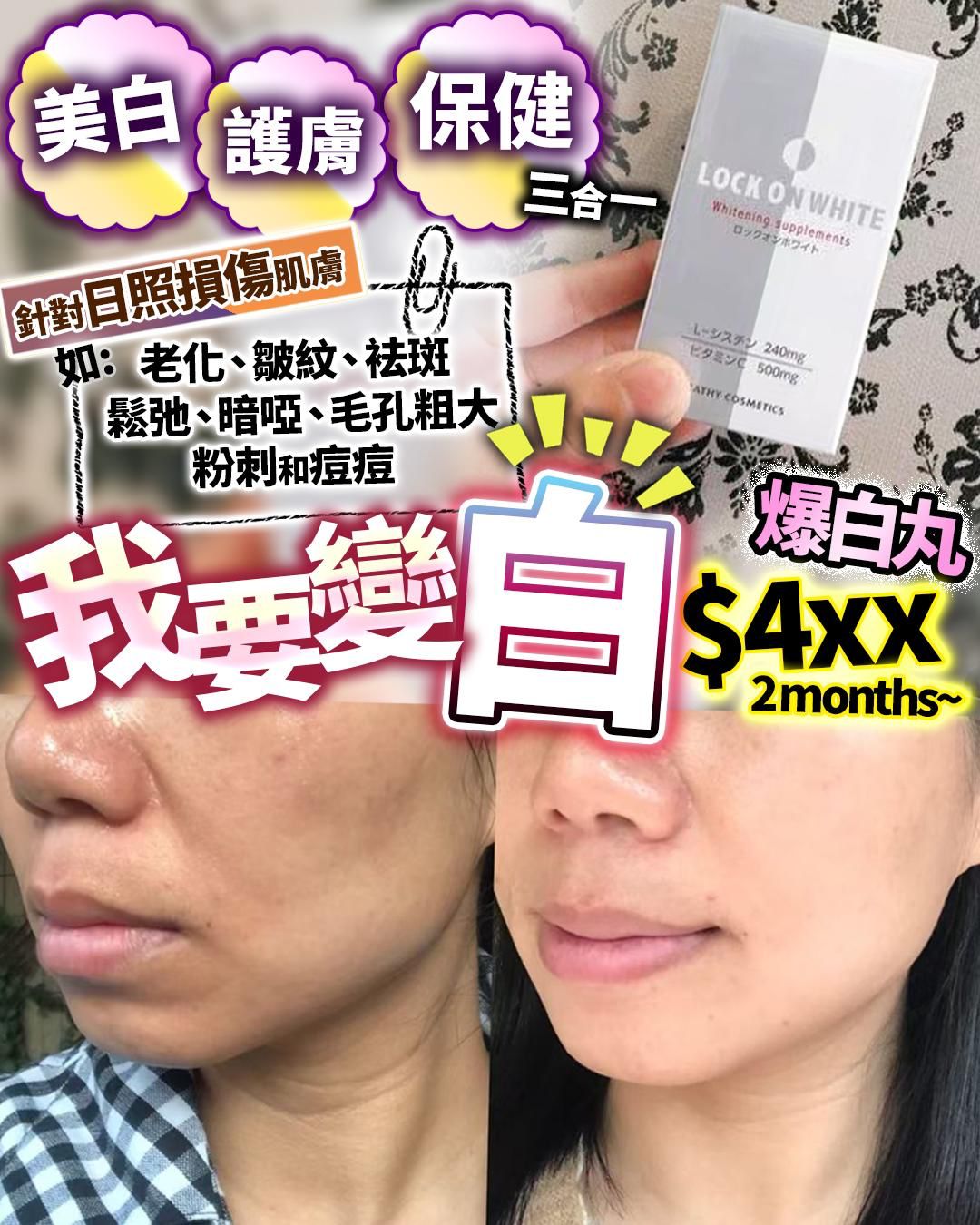 現貨🌸Lock on white 鎖住白 | 落單後約3-5個工作天寄出