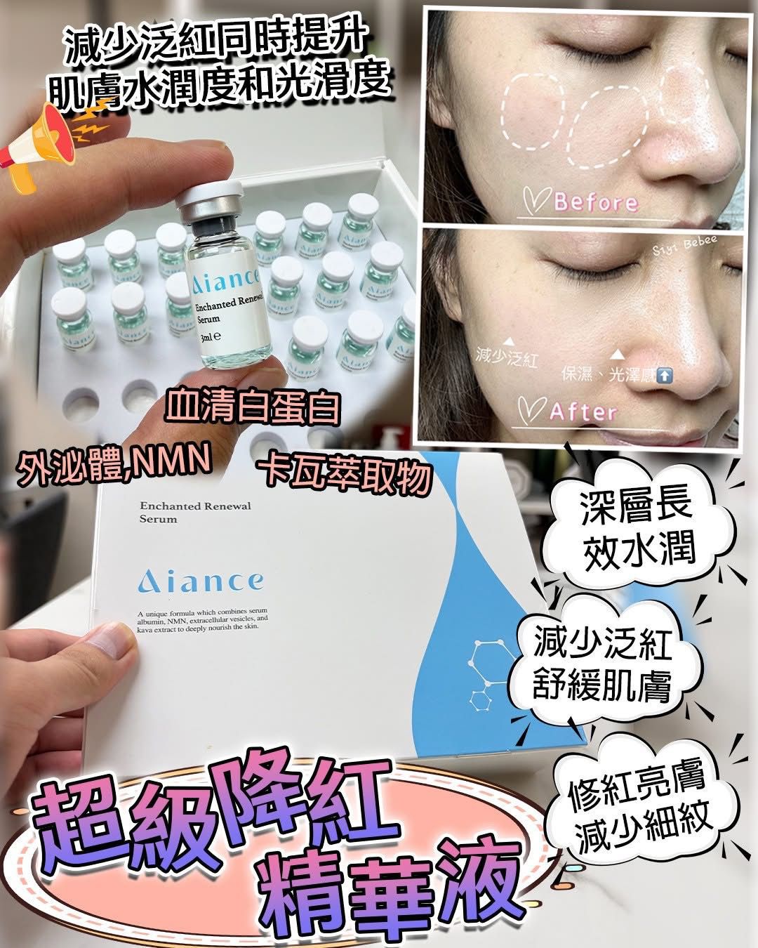 【24小時網站自助下單】少量現貨 🌸Aiance救急精華(1盒28支） | 落單後約3-5個工作天寄出 娉婷貿易公司 Exquisite Beauty Trading Company