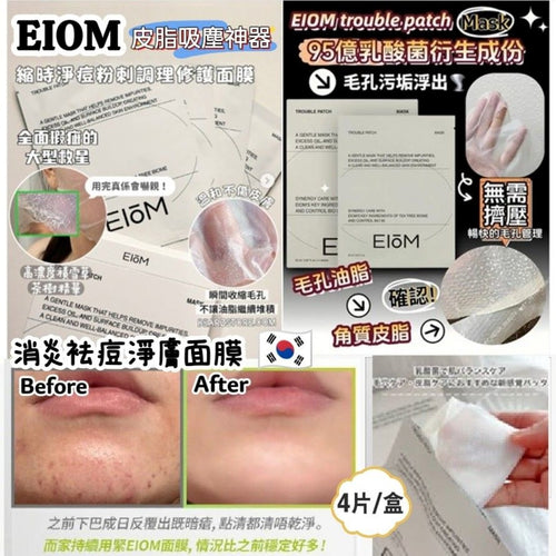 【24小時網站自助下單】現貨🌸EIOM 祛痘淨膚面膜（Trouble Patch Mask）1盒4片 | 落單後約3-5個工作天寄出 娉婷貿易公司 Exquisite Beauty Trading Company