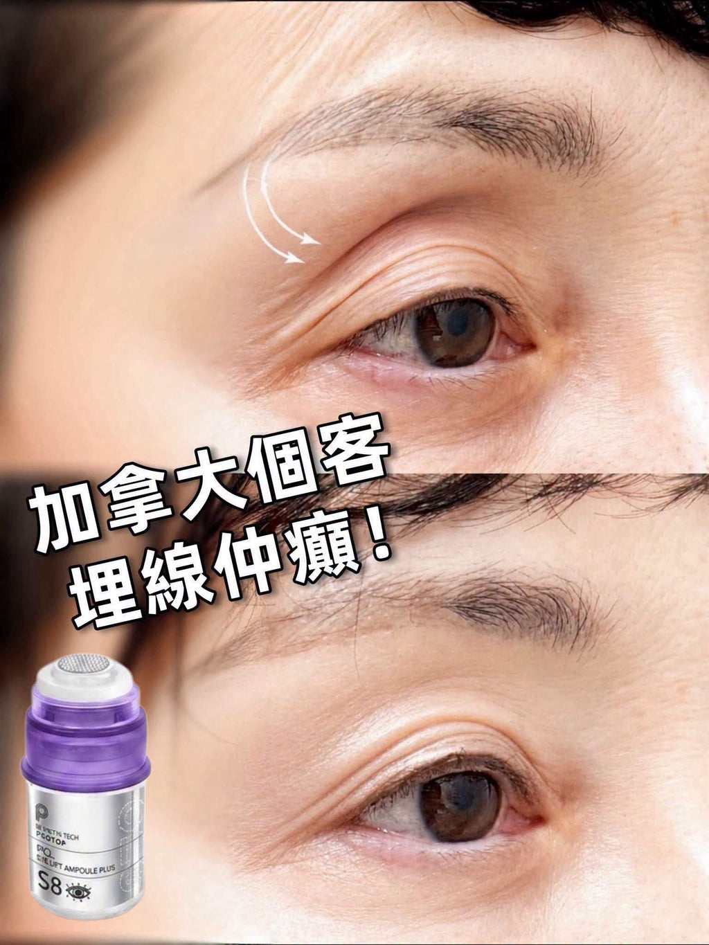 【24小時網站自助下單】🌸新品🆕🆕 Protop 眼pcl 3ml*1支 | 預訂約2-3星期 娉婷貿易公司 Exquisite Beauty Trading Company