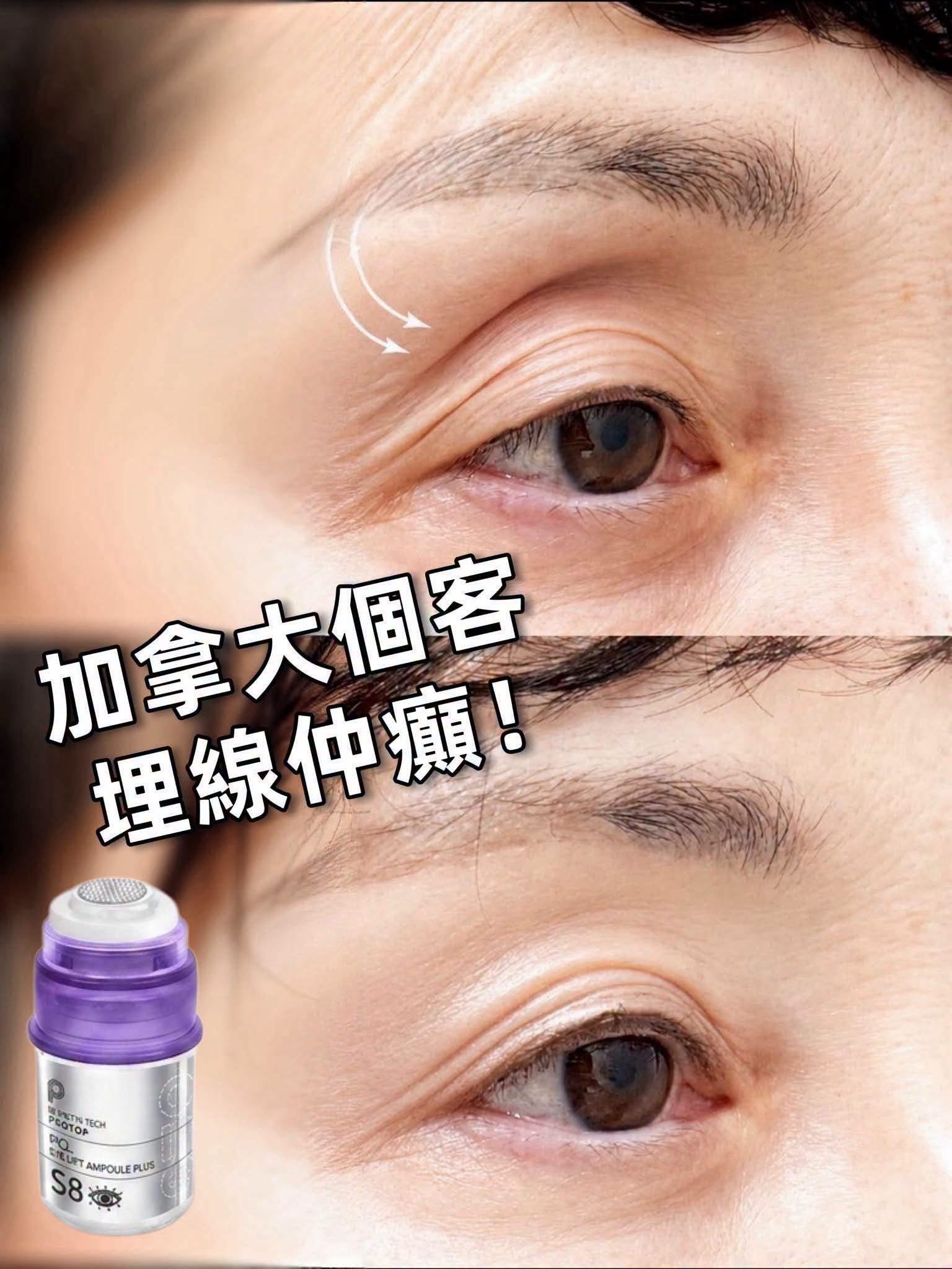 【24小時網站自助下單】🌸新品🆕🆕 Protop 眼pcl 3ml*1支 | 預訂約2-3星期 娉婷貿易公司 Exquisite Beauty Trading Company