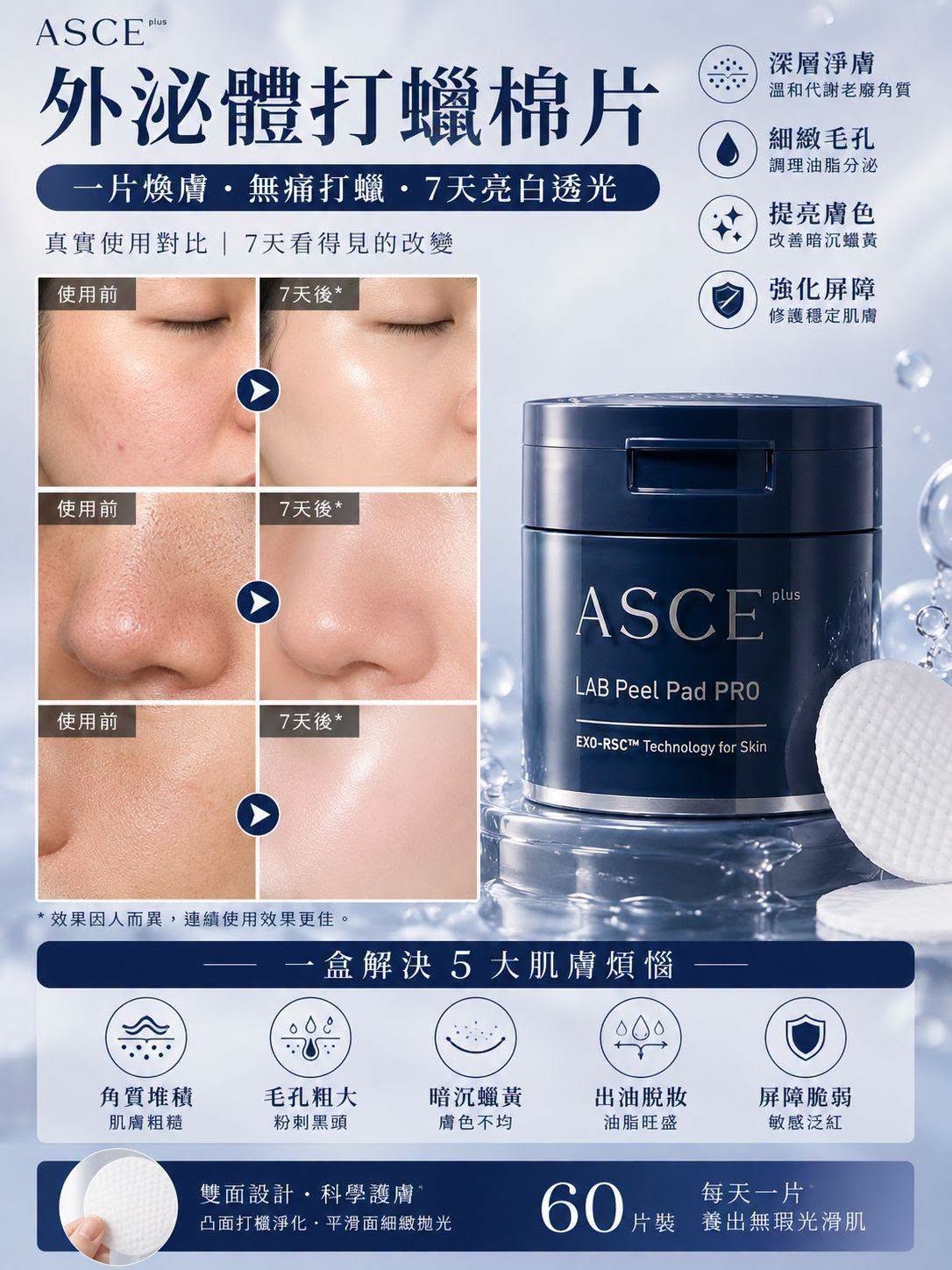 【24小時網站自助下單】🌸1秒童顏三部曲‼️‼️ASCE外泌體食細胞打蠟棉片（魔片）(1盒60片)/ASCE 神級外泌體魔水150ml /ASCE全新版-玫瑰外泌體面膜 (1盒5片) | 預訂約2-3星期 娉婷貿易公司 Exquisite Beauty Trading Company