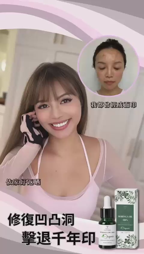 【24小時網站自助下單】現貨🌸🌟鑽石神仙去疤油 | 落單後約3-5個工作天寄出