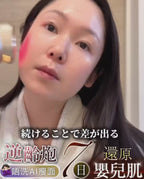 【24小時網站自助下單】🌸ANLAN 逆齡炮 LUMINA-R | 預訂約1-2星期