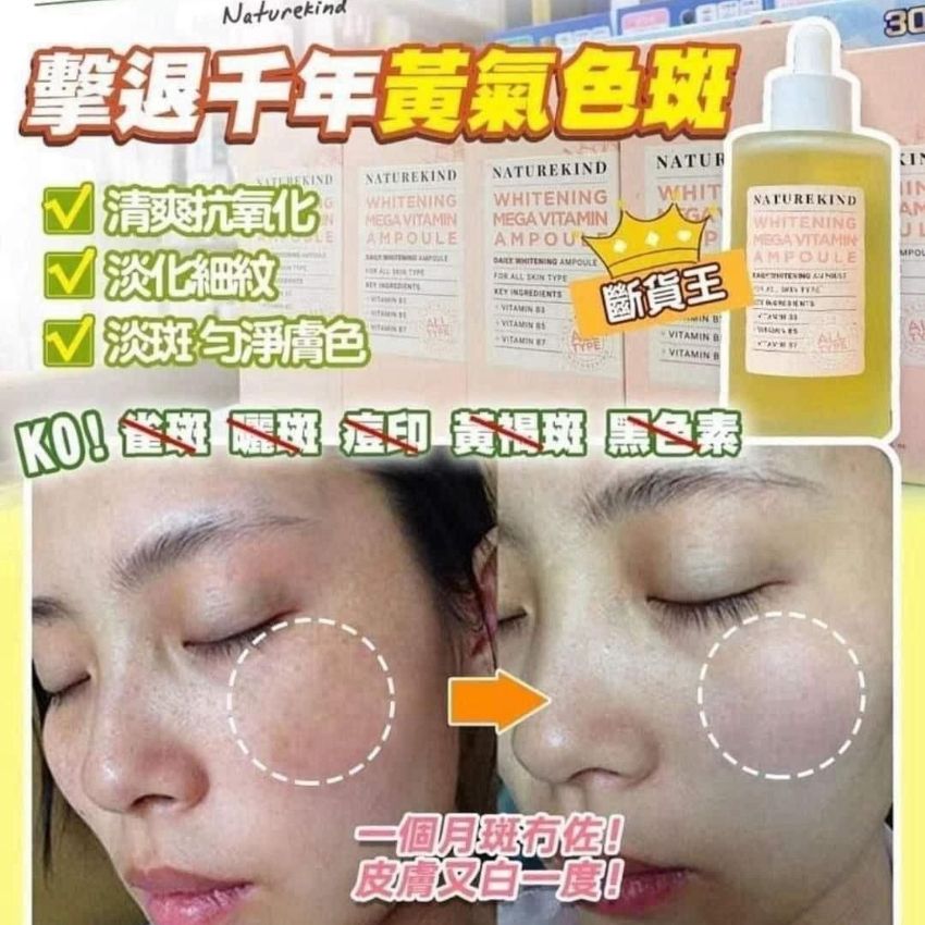 現貨🌸韓國直送 Naturekind 祛斑神仙水 100ml  | 落單後約3-5個工作天寄出