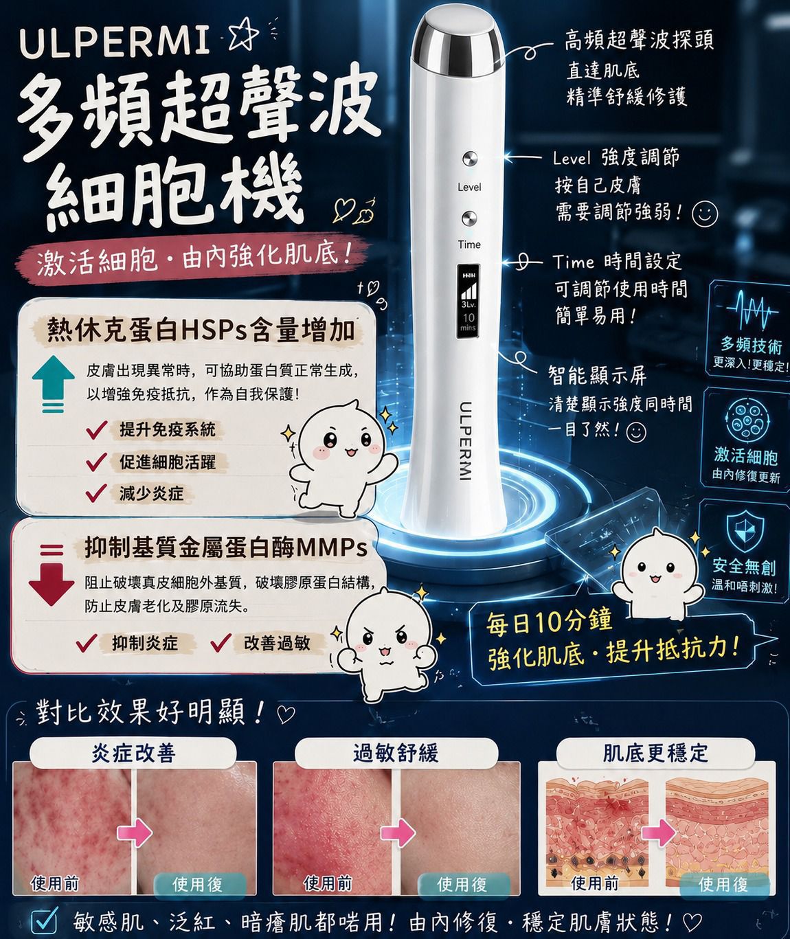【24小時網站自助下單】🌸ULPERMI 多頻超聲波細胞機 | 預訂約2-3星期 娉婷貿易公司 Exquisite Beauty Trading Company