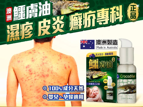 【24小時網站自助下單】供應商現貨🌸🐊Herb Standard正品藥業-鱷膚油 50ml🐊 | 預訂 逢星期一、三返倉執貨 其後約3-5個工作天寄出 娉婷貿易公司 Exquisite Beauty Trading Company
