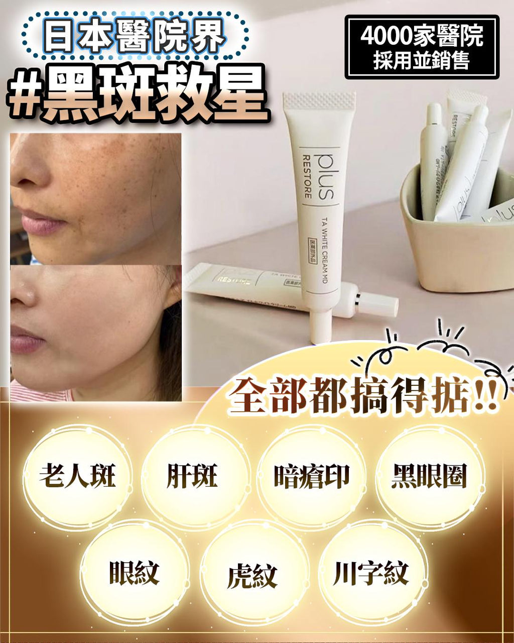 🌸日本 醫療級 黑斑救星 10g | 預訂約1星期
