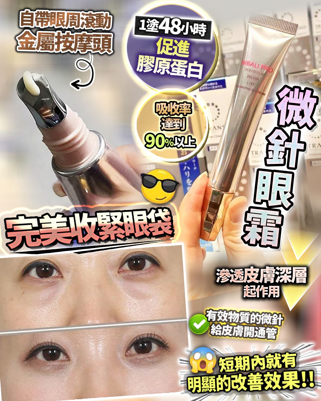 🌸微針眼 | 預訂約1-2星期